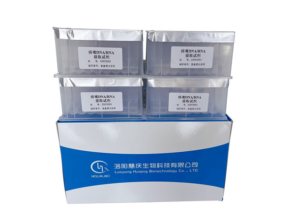 磁珠法核酸提取試劑盒的選購要求有哪些？