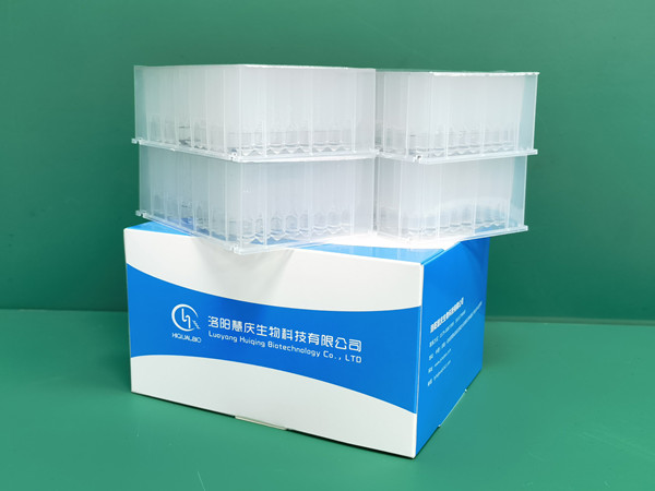 體外診斷行業(yè)的發(fā)展趨勢是什么？且看核酸提取試劑廠家解讀
